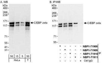 Western Blot: CBF2 Antibody [NBP1-71910] - Whole cell lysate from HeLa (5, 15 and 50 mcg for WB; 1 mg for IP, 20% of IP loaded) and 293T (T; 50 mcg) cells.  Affinity purified rabbit anti-C/EBP zeta antibody used for WB at 0.04 mcg/ml (A) and 1 mcg/ml (B) and used for IP at 6 mcg/mg lysate.  C/EBP zeta was also immunoprecipitated by rabbit anti-C/EBP zeta antibodies NBP1-71908 ,NBP1-71909 and NBP1-71911, which recognize other epitopes.