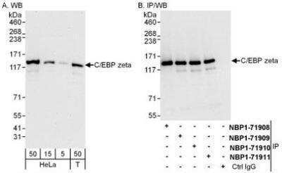 Western Blot: CBF2 Antibody [NBP1-71911] - Whole cell lysate from HeLa (5, 15 and 50 mcg for WB; 1 mg for IP, 20% of IP loaded) and 293T (T; 50 mcg) cells.   Affinity purified rabbit anti-C/EBP zeta antibody  used for WB at 0.04 mcg/ml (A) and 1 mcg/ml (B) and used for IP at 6 mcg/mg lysate.  C/EBP zeta was also immunoprecipitated by rabbit anti-C/EBP zeta antibodies NBP1-71908, NBP1-71909 and NBP1-71910, which recognize upstream epitopes.