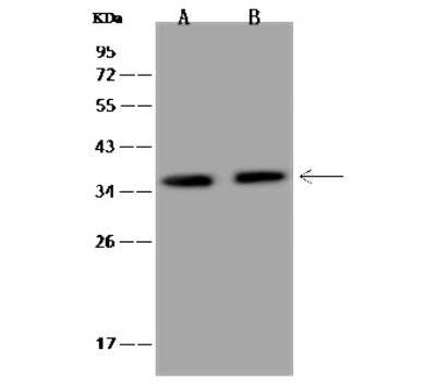 Western Blot: CBF2 Antibody [NBP2-97347] - Anti-CBF2 rabbit polyclonal antibody at 1:500 dilution. Lane A: HeLa Whole Cell Lysate Lane B: U-251 MG Whole Cell Lysate Lysates/proteins at 30 ug per lane. Secondary Goat Anti-Rabbit IgG (H+L)/HRP at 1/10000 dilution. Developed using the ECL technique. Performed under reducing conditions. Predicted band size: 19 kDa. Observed band size: 35 kDa