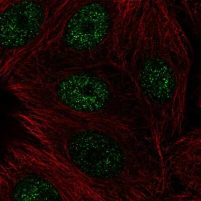 Immunocytochemistry/Immunofluorescence: CBFA2T3 Antibody [NBP2-56012] - Staining of human cell line MCF7 shows localization to nucleoplasm.