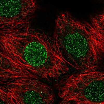 Immunocytochemistry/Immunofluorescence: CBFA2T3 Antibody [NBP2-56206] - Staining of human cell line MCF7 shows localization to nucleoplasm.