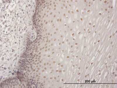 Immunohistochemistry-Paraffin: CBFA2T3 Antibody [H00000863-B01P] - Analysis of purified antibody to CBFA2T3 on formalin-fixed paraffin-embedded human esophagus. (antibody concentration 3 ug/ml)