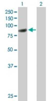 Western Blot CBFA2T3 Antibody