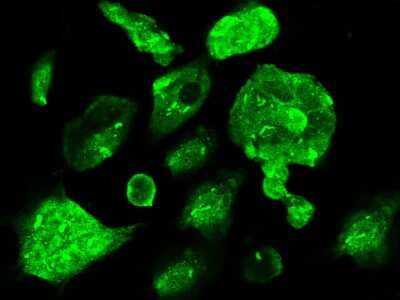 Immunocytochemistry/Immunofluorescence: CBFB Antibody [NBP2-98895] - Immunofluorescence staining of CBFB in 293 cells. Cells were fixed with 4% PFA, permeabilzed with 0.3% Triton X-100 in PBS, blocked with 10% serum, and incubated with rabbit anti-Human CBFB polyclonal antibody (dilution ratio 1:300) at 4C overnight. Then cells were stained with the Alexa Fluor$488-conjugated Goat Anti-rabbit IgG Secondary antibody (green). Positive staining was localized to cytoplasm and nucleus.