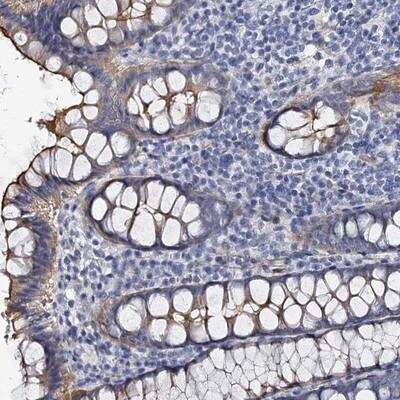 Immunohistochemistry-Paraffin: CBFB Antibody [NBP1-87300] - Staining of human colon shows moderate membranous positivity in glandular cells.