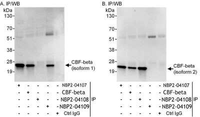 Immunoprecipitation: CBFB Antibody [NBP2-04107] - Whole cell lysate (1 mg for IP, 20% of IP loaded) from Jurkat cells. Antibodies: CBF-beta antibody NBP2-04107 used for IP at 6 ug/mg lysate. Isoform 1 and isoform 2 were also immunoprecipitated by CBF-beta antibody, which recognizes an epitope that is common to both isoform 1 and isoform 2. Isoform 1 was immunoprecipitated by CBF-beta (isoform 1) antibody NBP2-04109, and isoform 2 of CBF-beta was immunoprecipitated by CBF-beta (isoform 2) antibody NBP2-04108. For blotting immunoprecipitated CBF-beta, NBP2-04109 and NBP2-04107 were used at 1 ug/ml in A and B, respectively. Detection: Chemiluminescence with exposure times of 30 seconds (A and B).