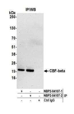 Immunoprecipitation: CBFB Antibody [NBP2-04107] - Detection of human CBF-beta by western blot of immunoprecipitates. Samples: Whole cell lysate (1.0 mg per IP reaction; 20% of IP loaded) from Jurkat cells prepared using NETN lysis buffer. Antibodies: Affinity purified rabbit anti-CBF-beta antibody NBP2-04107 (lot NBP2-04107-2) used for IP at 6 ug per reaction. CBF-beta was also immunoprecipitated by a previous lot of this antibody (lot NBP2-04107-1). For blotting immunoprecipitated CBF-beta, rabbit anti-CBF-beta antibody was used at 0.1 ug/ml. Detection: Chemiluminescence with an exposure time of 75 seconds.