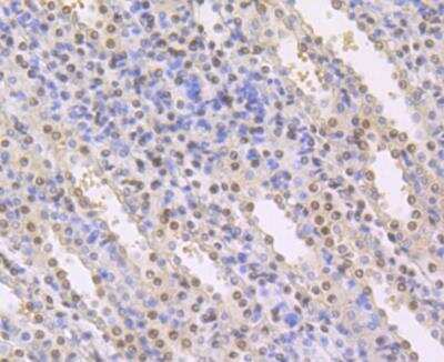 Immunohistochemistry: CBFB Antibody (JG39-35) [NBP2-76981] - Immunohistochemical analysis of paraffin-embedded rat kidney tissue using anti-CBFb antibody. Counter stained with hematoxylin.