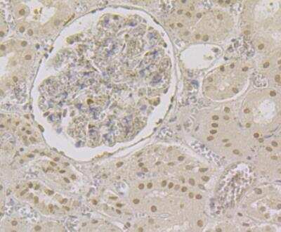Immunohistochemistry: CBFB Antibody (JG39-35) [NBP2-76981] - Immunohistochemical analysis of paraffin-embedded human kidney tissue using anti-CBFb antibody. Counter stained with hematoxylin.