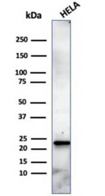 Western Blot: CBFB Antibody (PCRP-CBFB-1E6) [NBP3-13808] - Western blot analysis of HeLa cell lysate using CBFB antibody (PCRP-CBFB-1E6).