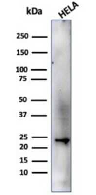 Western Blot: CBFB Antibody (PCRP-CBFB-1F6) [NBP3-13807] - Western blot analysis of HeLa cell lysate using CBFB antibody (PCRP-CBFB-1F6).