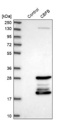 Western Blot: CBFB Antibody [NBP1-87300] - Analysis in control (vector only transfected HEK293T lysate) and CBFB over-expression lysate (Co-expressed with a C-terminal myc-DDK tag (3.1 kDa) in mammalian HEK293T cells).