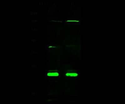 Western Blot: CBFB Antibody [NBP2-98895] - Anti-CBFB rabbit polyclonal antibody at 1:500 dilution. Lane A: Jurkat Whole Cell Lysate. Lane B: K562 Whole Cell Lysate. Lysates/proteins at 30 ug per lane. Secondary Goat Anti- Rabbit  IgG H&L (Dylight 800)  at 1/10000 dilution. Developed using the Odyssey technique. Performed under reducing conditions. Predicted band size: 22 kDa. Observed band size: 22 kDa