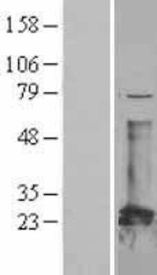 Western Blot: CBFb Overexpression Lysate (Adult Normal) [NBL1-08735] Left-Empty vector transfected control cell lysate (HEK293 cell lysate); Right -Over-expression Lysate for CBFb.