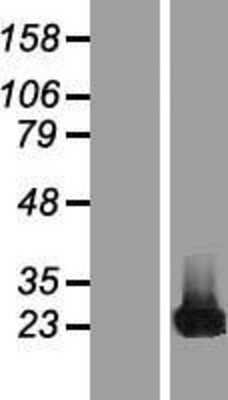 Western Blot: CBFb Overexpression Lysate (Adult Normal) [NBP2-06393] Left-Empty vector transfected control cell lysate (HEK293 cell lysate); Right -Over-expression Lysate for CBFb.