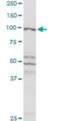 Western Blot: CBL Antibody [H00000867-D01P] - Analysis of CBL expression in MCF-7.