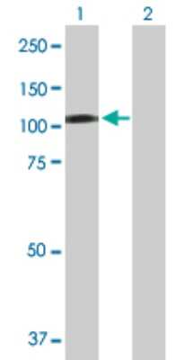 Western Blot: CBL Antibody [H00000867-D01P] - Analysis of CBL expression in transfected 293T cell line by CBL polyclonal antibody.Lane 1: CBL transfected lysate(99.60 KDa).Lane 2: Non-transfected lysate.