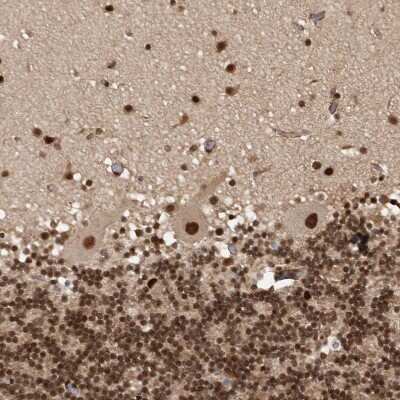 Immunohistochemistry-Paraffin CBLL1 Antibody - BSA Free