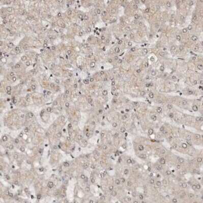 Immunohistochemistry-Paraffin CBLL1 Antibody - BSA Free