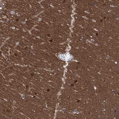 Immunohistochemistry-Paraffin CBLN3 Antibody - BSA Free