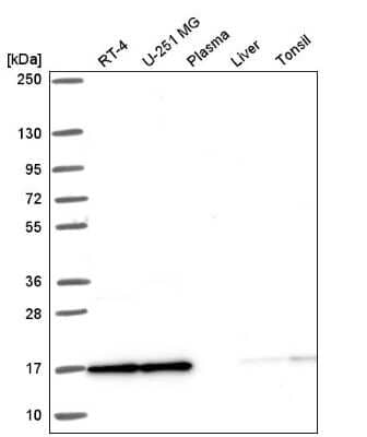 Western Blot CBP20 Antibody