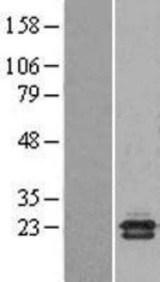 Western Blot CBP20 Overexpression Lysate