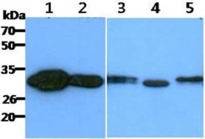 Western Blot: CBR1 Antibody (2D6) [NBP2-59397] - Lane 1: Recombinant Human CBR1, Lane 2: HeLa cell lysates, Lane 3: 293T cell lysates, Lane 4: MCF-7 cell lysates, Lane 5: HepG2 cell lysates