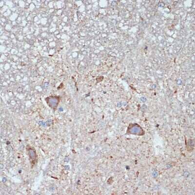 Immunohistochemistry-Paraffin: CBR1 Antibody (3A9O5) [NBP3-15724] - Immunohistochemistry of paraffin-embedded mouse spinal cord using CBR1 Rabbit mAb (NBP3-15724) at dilution of 1:100 (40x lens).Perform microwave antigen retrieval with 10 mM Tris/EDTA buffer pH 9.0 before commencing with IHC staining protocol.