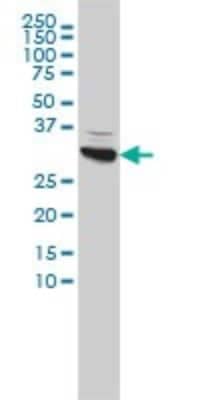 Western Blot: CBR1 Antibody (4D12-1G8) [H00000873-M02] - CBR1 monoclonal antibody (M02), clone 4D12-1G8 Analysis of CBR1 expression in Hela.