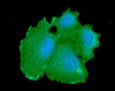 Immunocytochemistry/Immunofluorescence: CBR1 Antibody (4E12) [NBP1-74041] -  Analysis of CBR1 in Hep3B cells line, stained with DAPI (Blue) for nucleus staining and monoclonal anti-CBR1 antibody (1:100) with goat anti-mouse IgG-Alexa fluor 488 conjugate (Green).