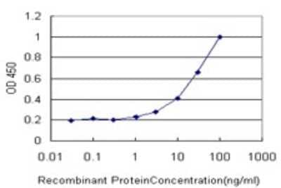 Sandwich ELISA: CBR1 Antibody (4G11-1C7) [H00000873-M01] - Detection limit for recombinant GST tagged CBR1 is approximately 1ng/ml as a capture antibody.