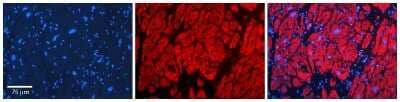 Immunohistochemistry-Paraffin: CBR1 Antibody [NBP1-52871] - Formalin Fixed Paraffin Embedded Tissue: Human heart Tissue Observed Staining: Cytoplasmic Primary Antibody Concentration: N/A Other Working Concentrations: 1:600 Secondary Antibody: Donkey anti-Rabbit-Cy3 Secondary Antibody Concentration: 1:200 Magnification: 20X Exposure Time: 0.5 - 2.0 sec