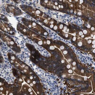 Immunohistochemistry-Paraffin: CBR1 Antibody [NBP1-86595] - Staining of human duodenum shows strong positivity in glandular cells.