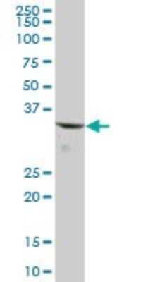Western Blot: CBR1 Antibody [H00000873-B01P] - Analysis of CBR1 expression in human liver.
