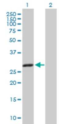 Western Blot: CBR1 Antibody [H00000873-B01P] - Analysis of CBR1 expression in transfected 293T cell line by CBR1 polyclonal antibody.  Lane 1: CBR1 transfected lysate(30.47 KDa). Lane 2: Non-transfected lysate.
