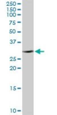 Western Blot: CBR1 Antibody [H00000873-D01P] - Analysis of CBR1 expression in human liver.