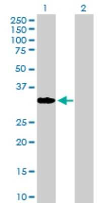 Western Blot: CBR1 Antibody [H00000873-D01P] - Analysis of CBR1 expression in transfected 293T cell line by CBR1 polyclonal antibody.Lane 1: CBR1 transfected lysate(30.40 KDa).Lane 2: Non-transfected lysate.