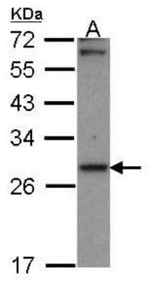 Western Blot: CBR1 Antibody [NBP1-30942] - A431, diluted at 1:1000 with 12% SDS PAGE gel.