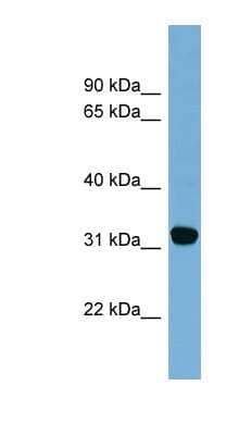 Western Blot: CBR1 Antibody [NBP1-52871] - OVCAR-3 cell lysate, concentration 0.2-1 ug/ml.