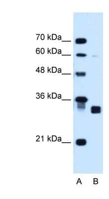 Western Blot: CBR1 Antibody [NBP1-52872] - HepG2 cell lysate, concentration 1.25ug/ml.