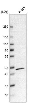 Western Blot CBR1 Antibody