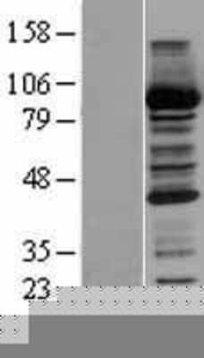 Western Blot: CBR1 Overexpression Lysate (Adult Normal) [NBP2-04206] Left-Empty vector transfected control cell lysate (HEK293 cell lysate); Right -Over-expression Lysate for CBR1.