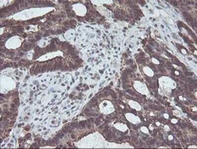 Immunohistochemistry-Paraffin CBR3 Antibody (OTI1G6)