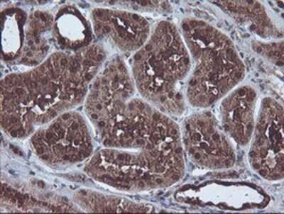 Immunohistochemistry-Paraffin: CBR3 Antibody (1G6) [NBP2-00997] - Staining of paraffin-embedded Human Kidney tissue using anti-CBR3 mouse monoclonal antibody.