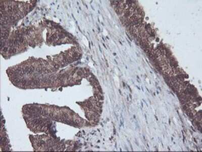 Immunohistochemistry-Paraffin: CBR3 Antibody (1G6) [NBP2-00997] - Staining of paraffin-embedded Human prostate tissue using anti-CBR3 mouse monoclonal antibody.