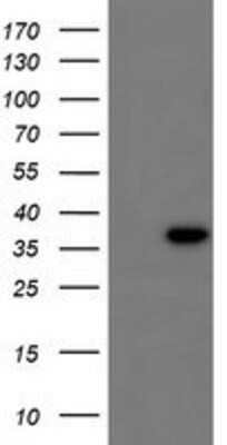 Western Blot: CBR3 Antibody (1G6) [NBP2-00997] - HEK293T cells were transfected with the pCMV6-ENTRY control (Left lane) or pCMV6-ENTRY CBR3 (Right lane) cDNA for 48 hrs and lysed. Equivalent amounts of cell lysates (5 ug per lane) were separated by SDS-PAGE and immunoblotted with anti-CBR3.