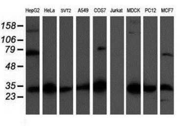 Western Blot: CBR3 Antibody (1G6) [NBP2-00997] Analysis of extracts (35ug) from 9 different cell lines by using anti-CBR3 monoclonal antibody.