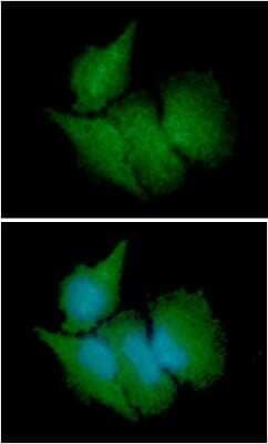 Immunocytochemistry/Immunofluorescence: CBR3 Antibody (7E8) [NBP2-59401] - Analysis of CBR3 in HeLa cells line, stained with DAPI (Blue) for nucleus staining and monoclonal anti-human   CBR3 antibody (1:100) with goat anti-mouse IgG-Alexa fluor 488 conjugate (Green).