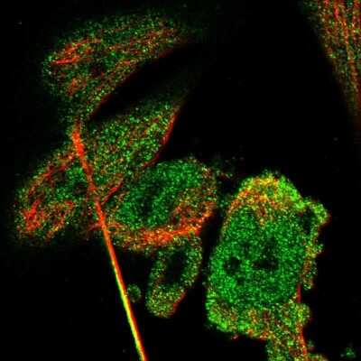 Immunocytochemistry/Immunofluorescence: CBR3 Antibody [NBP1-87065] - Staining of human cell line U-251MG shows positivity in nucleus but not nucleoli and cytoplasm.