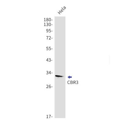 Western Blot: CBR3 Antibody (S06-7B3) [NBP3-19596] - Western blot detection of CBR3 in Hela lysates using NBP3-19596. Predicted band size: 31kDa. Observed band size: 31kDa.